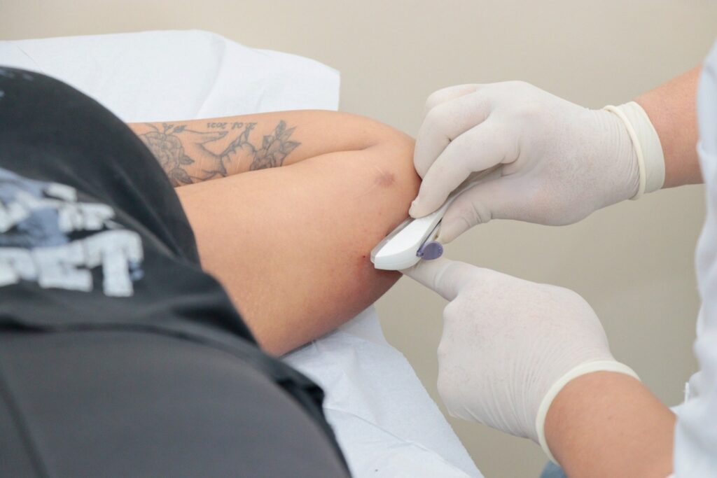Implante hormonal (Implanon)- Dra. Yedda Reis - Médica mastologista, ginecologista e obstetra em São Paulo